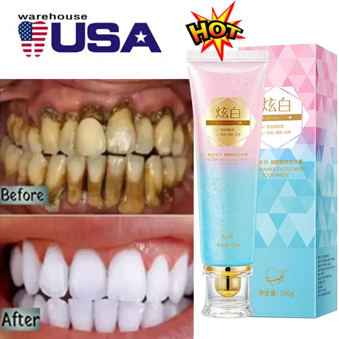 Niacinamide Whitening Toothpaste -  For Healthier & Whiter Teeth