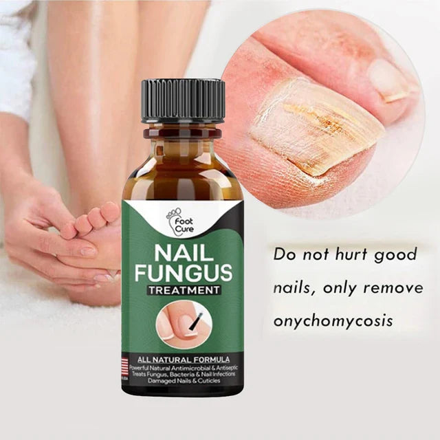Nail Fungus Solution In Pakistan By Pure Care